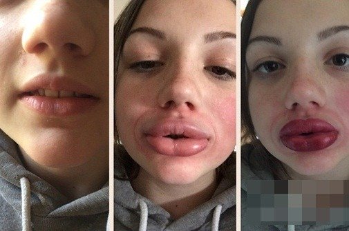 Ác mộng làm đẹp thời hiện đại của phụ nữ trong mắt đàn ông