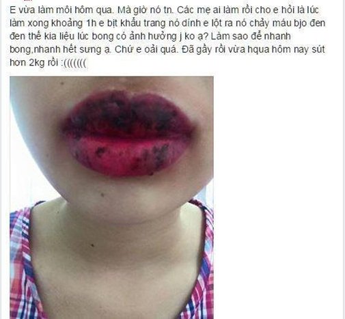 Ác mộng làm đẹp thời hiện đại của phụ nữ trong mắt đàn ông