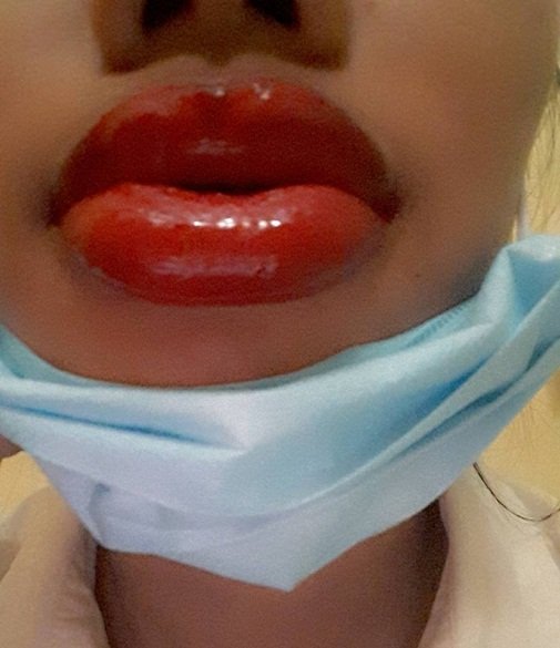 Ác mộng làm đẹp thời hiện đại của phụ nữ trong mắt đàn ông
