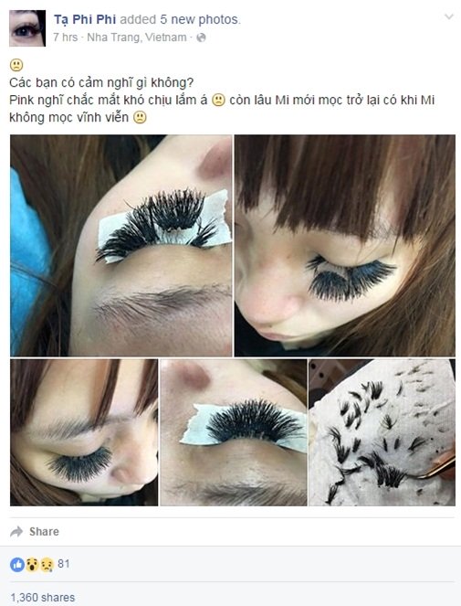 Ác mộng làm đẹp thời hiện đại của phụ nữ trong mắt đàn ông