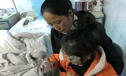Bố sạc điện thoại cạnh giường khiến con gái bị bỏng nặng