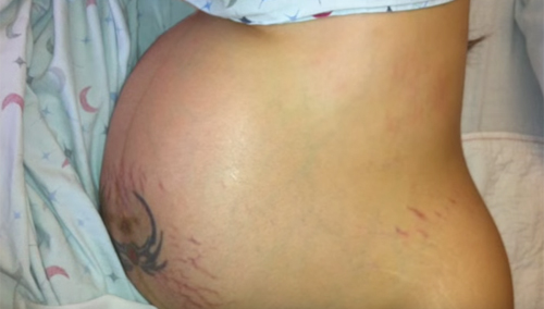 ngo mang thai doi, cu moi lan sieu am, me lai choang vang vi co them mot con - 5