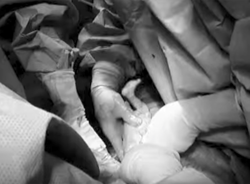 ngo mang thai doi, cu moi lan sieu am, me lai choang vang vi co them mot con - 6