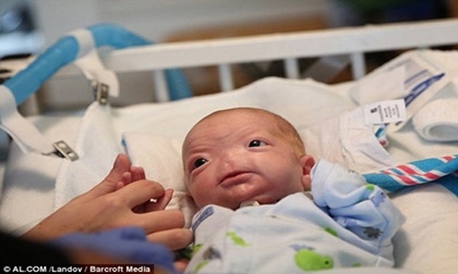 Em bé không có mũi nổi tiếng thế giới đã qua đời khi vừa đón sinh nhật lần 2