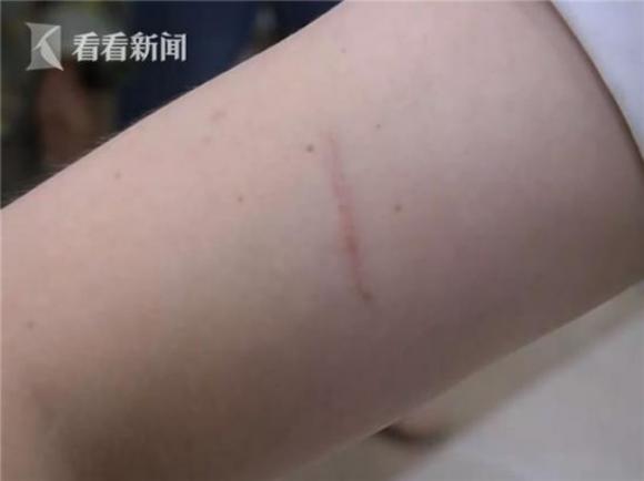 Chia tay đòi quà có tổng giá trị hơn 800 triệu đồng, cặp đôi lao vào đánh nhau nhập viện sau 8 năm mặn nồng - Ảnh 2. Chia tay đòi quà có tổng giá trị hơn 800 triệu đồng, cặp đôi lao vào đánh nhau nhập viện sau 8 năm mặn nồng - Ảnh 2.