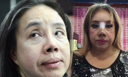 Nữ đại gia Thái Lan 'yêu' 28 lần/ngày xuất hiện trở lại với chiếc mũi 'mới toanh'