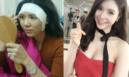 Thực hư chuyện Thanh Bi 'đập đi xây lại' toàn bộ cơ thể gây sốc