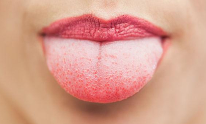 Nước bọt có biểu hiện này chạy tới bệnh viện ngay kẻo hối hận
