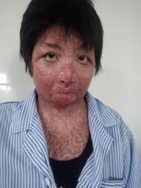 Chị Trang sẽ được làm phẫu thuật da mặt trong thời gian tới (ảnh nhân vật cung cấp)