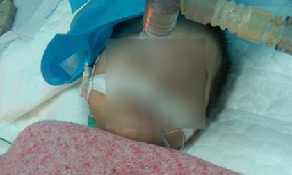 Hà Nội: Bé gái 8 tháng tuổi hôn mê nguy kịch nghi do tiêm nhầm thuốc