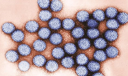 Virus nguy hiểm gây tử vong hàng đầu ở Việt Nam