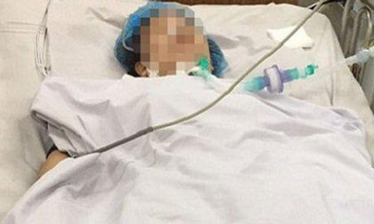 TPHCM: Người phụ nữ nguy kịch sau phẫu thuật gọt cằm đã tử vong sau 5 tháng điều trị