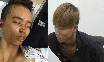 Người dân kể lại phút kinh hoàng cướp đâm 2 người truy đuổi