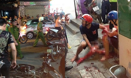3 điều phải nhớ khi bị cướp giật