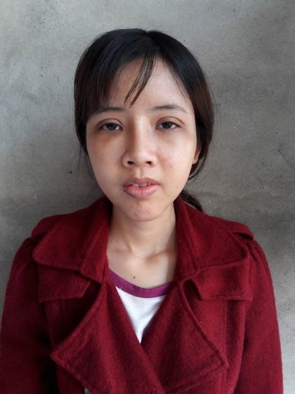 Từng có ý định tử tự vì bị ví Thị Nở thời hiện đại, cô gái đến từ Bắc Ninh quyết thẩm mỹ khiến người thân không nhận ra-3