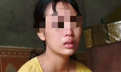 Sản phụ 16 tuổi cầu cứu vì chồng bạo hành: Người chồng lên tiếng phân trần