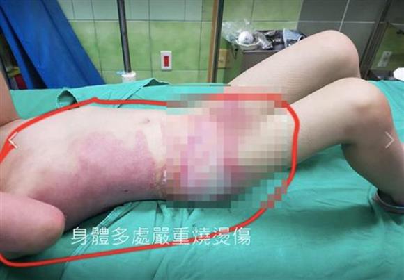 thay con gai 5 tuoi bi bong nang, bo me chet dung khi kiem tra camera truong mau giao - 1