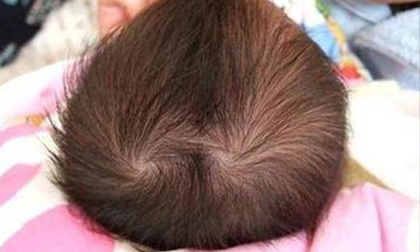 Nhìn xoáy tóc của trẻ sơ sinh biết vận mệnh tương lai, kiểu thứ 6 thông minh bẩm sinh