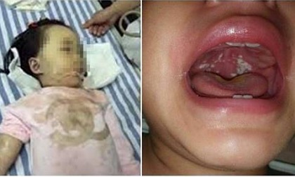 Mới 14 tháng bé đau họng đã tử vong, bác sĩ cảnh báo thiếu sót chết người của mẹ mà nhiều người cũng mắc