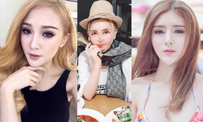 Rùng mình trước chuyện phẫu thuật thẩm mỹ của 3 'búp bê di động' nghiện dao kéo
