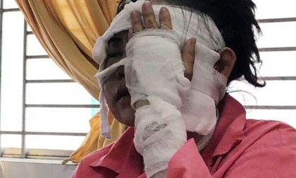 Cô gái sắp cưới bị tạt axit hỏng 2 mắt ở Sài Gòn: 'Tôi đau đớn lắm, có thể đám cưới sẽ phải dời lại để lo chữa trị'