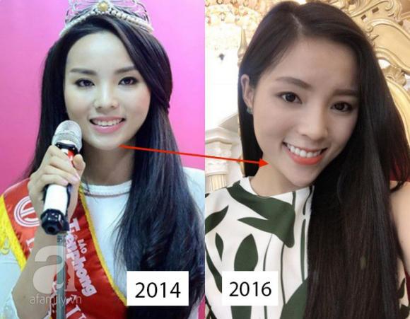 Cuối cùng thì Kỳ Duyên cũng nhận mình có tác động thẩm mỹ sau tất cả những thay đổi trên khuôn mặt 1