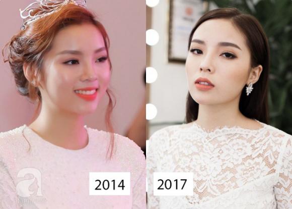 Cuối cùng thì Kỳ Duyên cũng nhận mình có tác động thẩm mỹ sau tất cả những thay đổi trên khuôn mặt 4