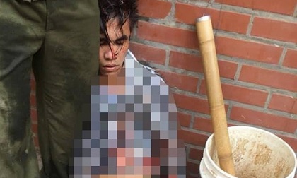 Hà Nội: Trộm xe trong lúc người dân đang chữa cháy, nam thanh niên bị đánh nhừ tử