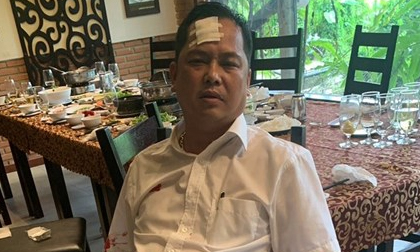 Vụ vây xe chở công an ở Đồng Nai: Người bị đánh vỡ trán gửi yêu cầu khởi tố vụ án