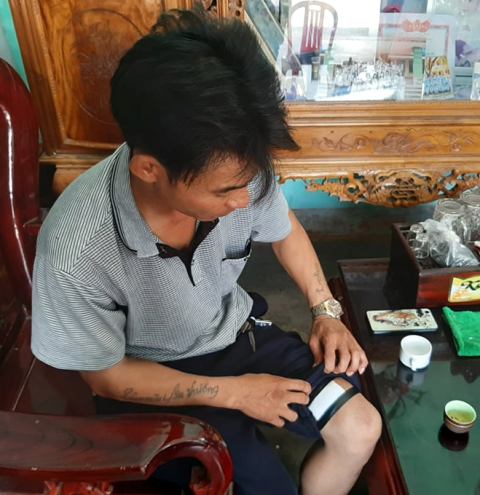 phut sinh tu doi mat voi ke cuop co sung cua bao ve ngan hang hinh anh 1