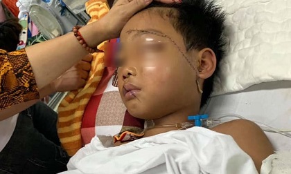Tin mới nhất về sức khỏe bé trai bị chú chém lìa tay ở Bắc Giang