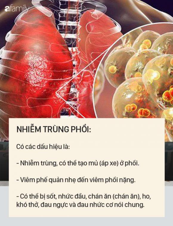 Dấu hiệu bệnh whitmore - căn bệnh do vi khuẩn ăn mòn cơ thể con người, có thể gây tử vong trong vài ngày - 2