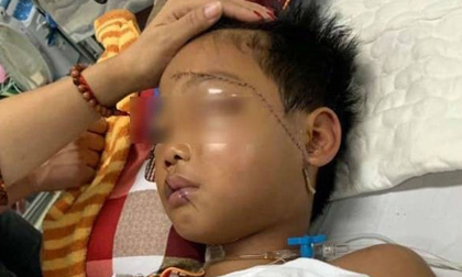 Vụ cháu bé bị bác họ chém đứt lìa tay ở Bắc Giang: Nạn nhân vô cùng sợ hãi, hoảng loạn khi tỉnh lại