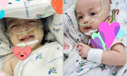 Tin vui: Hai bé Trúc Nhi - Diệu Nhi đã cai máy thở, sức khoẻ ổn định