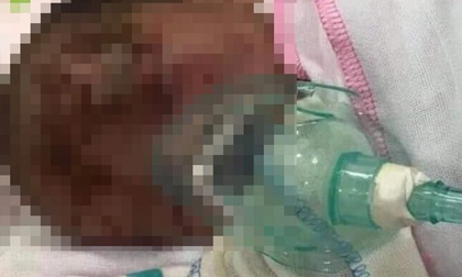 Phát hiện một bé trai khoảng 3 ngày tuổi bị bỏ rơi ven đường, trên mặt có nhiều vết xước