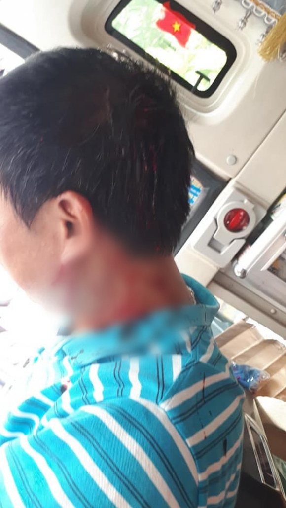 Nhân viên phụ xe bị đánh gục giữa lòng Hà Nội: 'Tôi không ngờ họ lại đánh mình dã man đến thế'