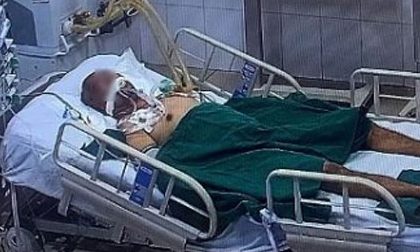 Bệnh nhân Covid-19 ở Hà Nội tiên lượng rất nặng, tổn thương phổi gần như toàn bộ