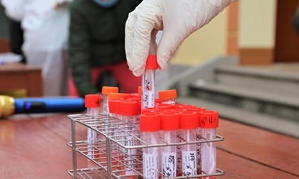 Nóng: 5 ca mắc Covid-19 tại Yên Bái đều nhiễm biến chủng virus Ấn Độ