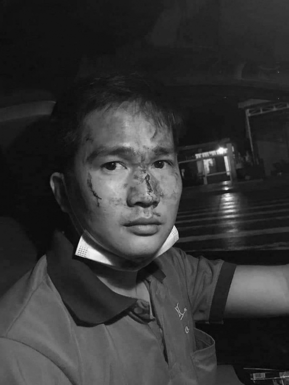 Thanh niên đánh tài xế taxi đổ máu ở Bình Phước đã đưa vợ, con rời khỏi nơi tạm trú - Ảnh 1.