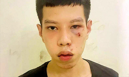 Hà Nội: Anh trai lấy tiền cướp giật chia cho em khiến cả 2 vướng vòng lao lý
