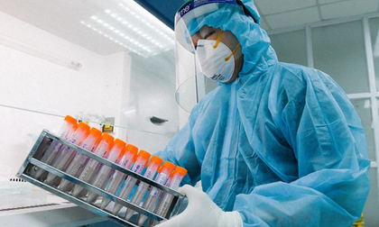 Đại diện CDC Hà Nội thông tin 'nóng' về việc mua kit test Covid-19 của Công ty Việt Á