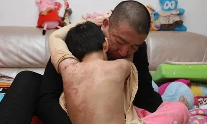 Mẹ hùa theo nhân tình bạo hành man rợ con gái: Găm kim vào đùi, giội nước sôi vào đầu