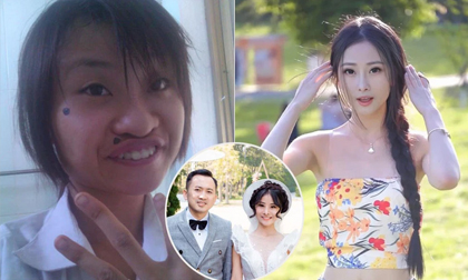 Cô gái 'xấu nhất mạng xã hội' lột xác xinh đẹp, lấy chồng hai là đại gia Việt kiều