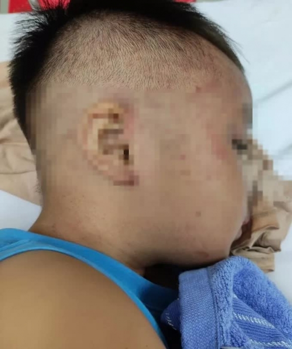 Nóng: Cứu thành công bé trai 3,5 tuổi ở Hà Nam nghi bị bạo hành, nhốt trong tủ cấp đông - Ảnh 1.