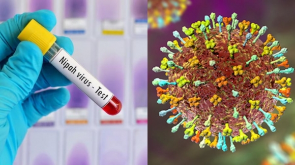 WHO cảnh báo một đại dịch toàn cầu có thể xuất hiện do virus Nipah