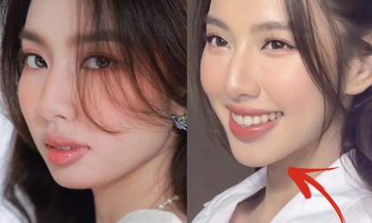 Hoa hậu Thuỳ Tiên vướng nghi vấn 'dao kéo', bị soi điểm khác lạ trên gương mặt